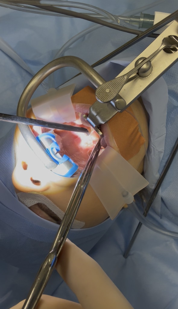 surgical device