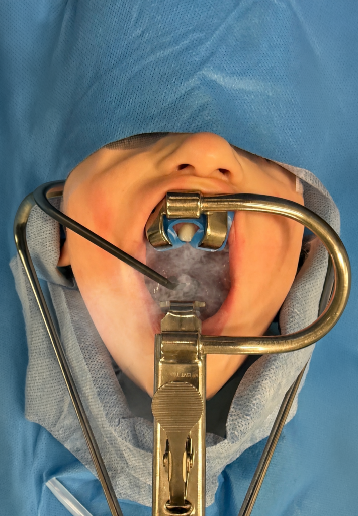 surgical device 1