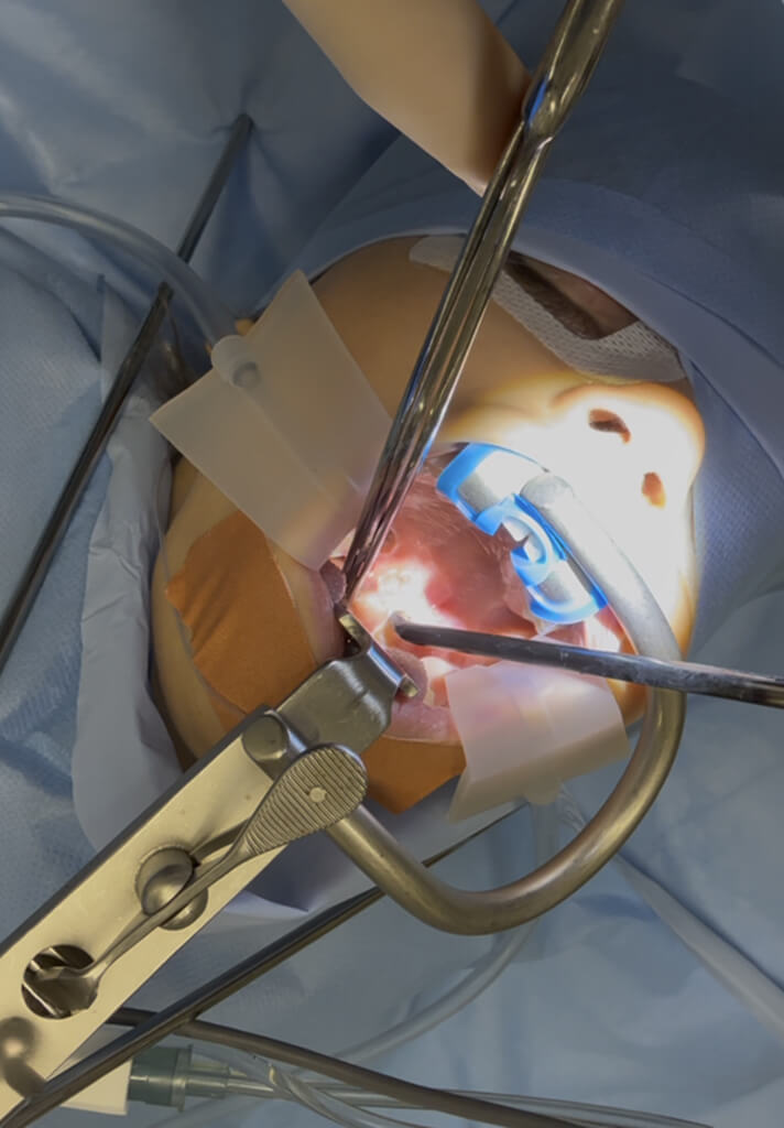 Designed for Upper Airway Procedures